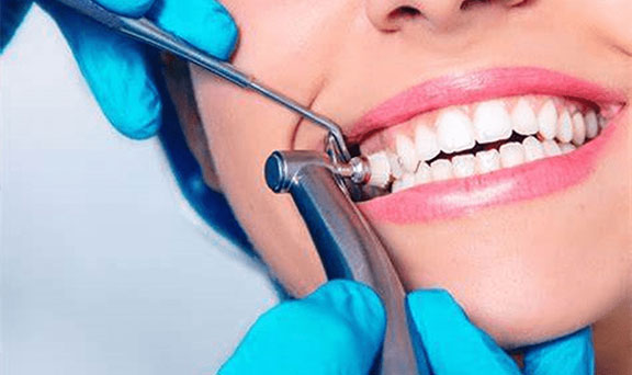 teeth-cleaning-in-kharadi