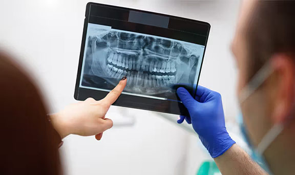 dental-x-ray-in-kharadi