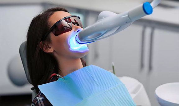 Get the best teeth whitening in Kharadi at affordable price.